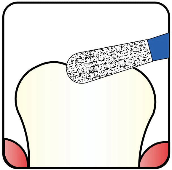 💎 The Versatile Diamond Bur 237 Pear Shape: A Dentist's Best Friend