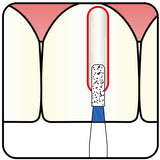 Cylindrical 0.8 mm Dia. Fine Grit Diamond Bur 5 per pack. 107.8F1 - Osung USA