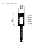 6mm/5mm Osung B60 Implant Trephine Bur Drill -THB60 - Osung USA