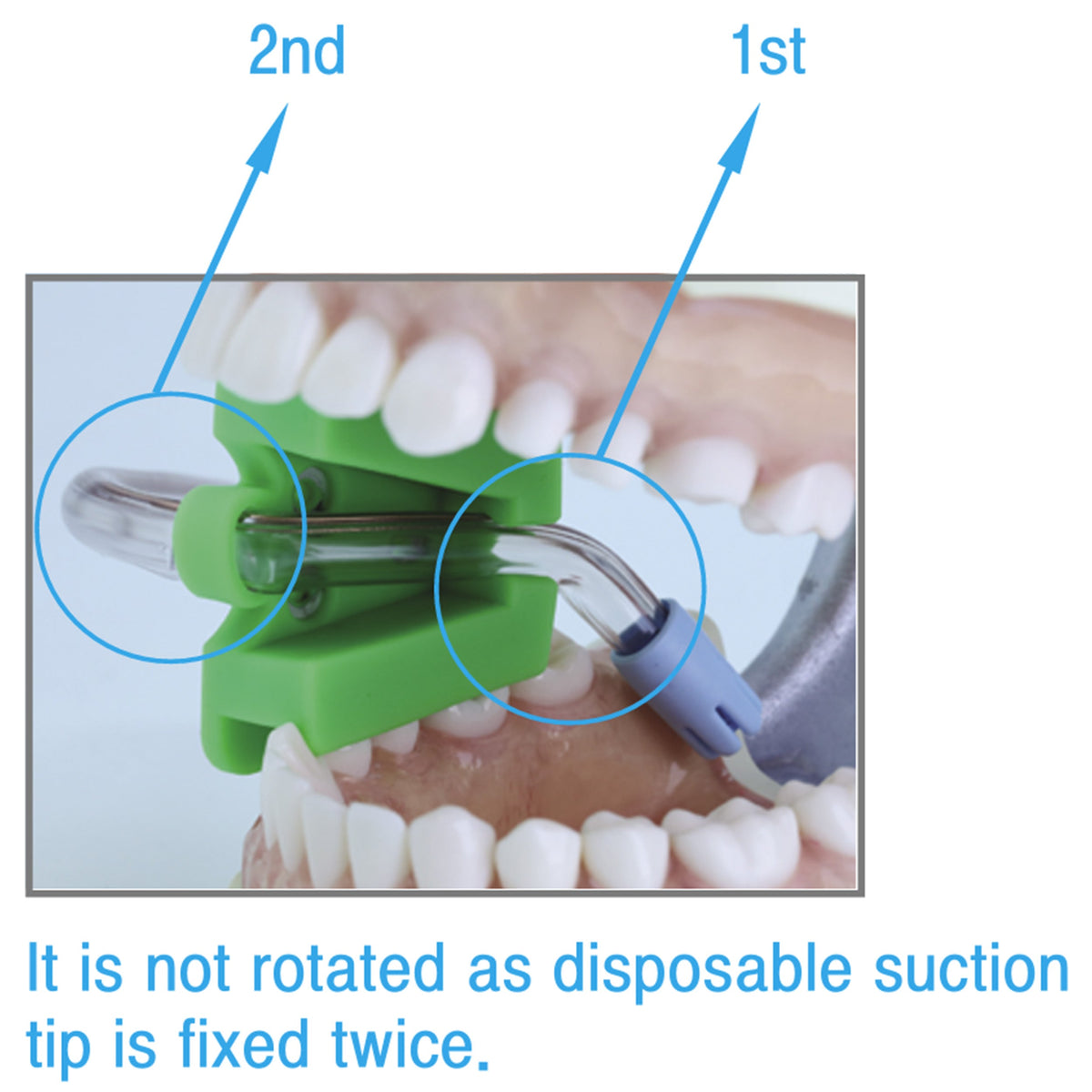 Dental Large Mouth Prop Autoclavable Osung -MPL | Osung USA